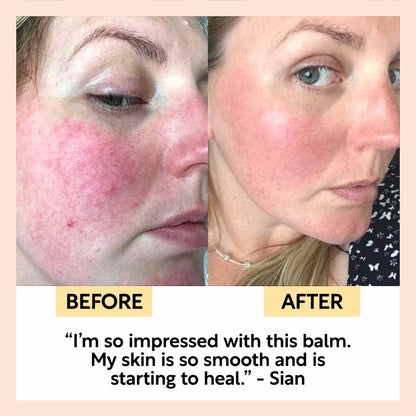 upcircle natural cleansing balm before and after comparison showing reduced skin redness and improved texture
